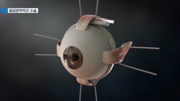 ▲'명의' (사진제공=EBS1)