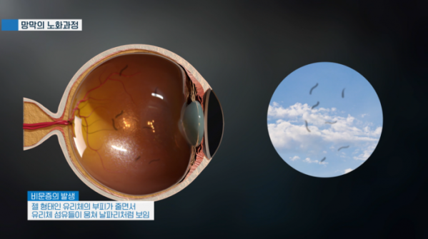 ▲'명의' (사진제공=EBS1)