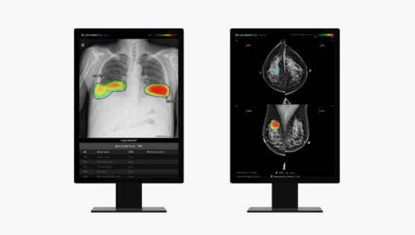 ▲루닛 흉부 엑스레이 AI 영상분석 솔루션 '루닛 인사이트 CXR'(왼쪽)과 유방촬영술 AI 영상분석 솔루션 ' 루닛 인사이트 MMG'.  (사진제공=루닛)