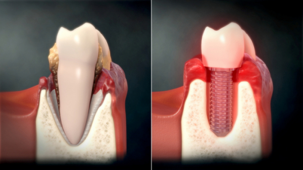 ▲'명의' (사진제공=EBS1)