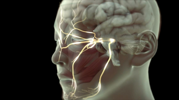 ▲'명의' 삼차신경통(사진제공=EBS1)