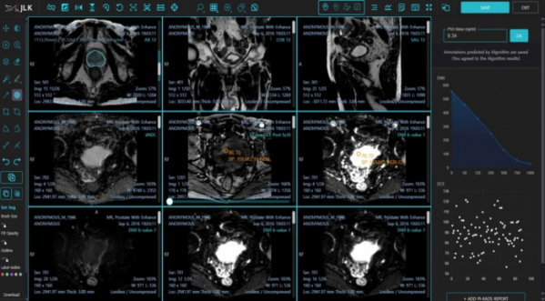 ▲제이엘케이의 전립선암 진단 솔루션 ‘MEDIHUB Prostate’의 구동 화면. (사진제공=제이엘케이)