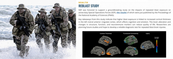 ▲잦은 총기 폭발음에 노출된 미국 해군 특수부대원은 정상인과 다른 뇌 특성(두꺼운 피질)을 지닌 것으로 조사됐다. 하버드대학 연구결과에 따르면 이는 '환각 및 정신질환'과 상관관계를 지닌다.  (출처 네이비실파운데이션)