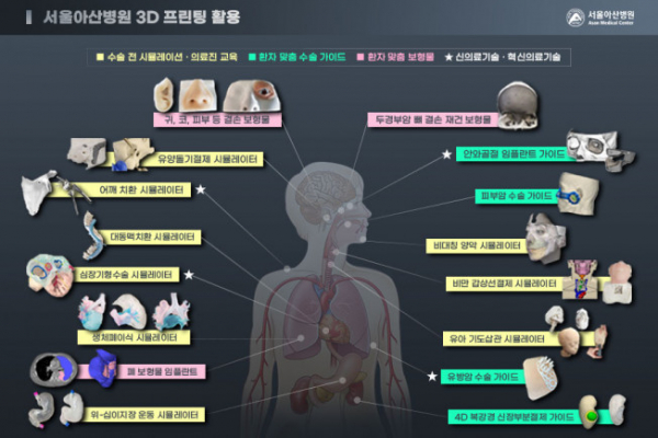 (사진제공=서울아산병원)