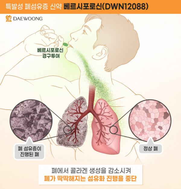 (사진제공=대웅제약)