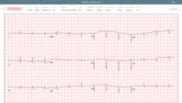 ▲뷰노메드 딥ECG LVSD 운영화면 예시. (사진제공=뷰노)