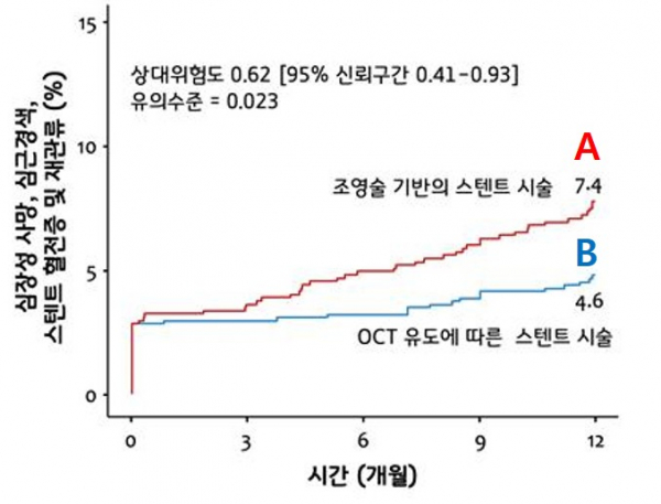 ▲기존의 치료법(A)과 OCT 유도 중재술(B) 간 합병증 발생률 비교 (제공=세브란스 심장혈관병원)