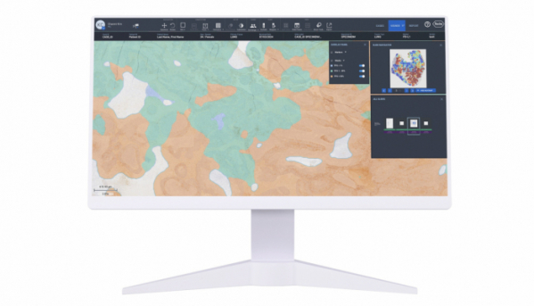 ▲로슈진단 '네비파이 디지털 병리' 플랫폼에 통합된 루닛 AI 병리분석 솔루션 '루닛 스코프 PD-L1'의 화면. (사진제공=루닛)