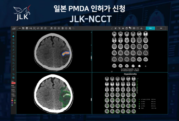 ▲제이엘케이가 일본 PMDA에 뇌졸중 AI 솔루션 ‘JLK-NCCT’의 인허가를 신청했다. (사진제공=제이엘케이)