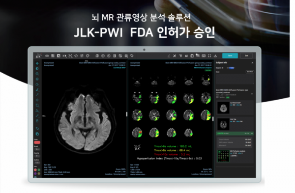 ▲제이엘케이의 뇌관류 MR 영상 분석 솔루션(JLK-PWI)이 미국 FDA 시판 전 허가를 획득했다. (사진제공=제이엘케이)