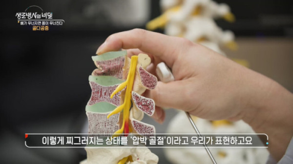 ▲'생로병사의_비밀'(사진제공=KBS 1TV)