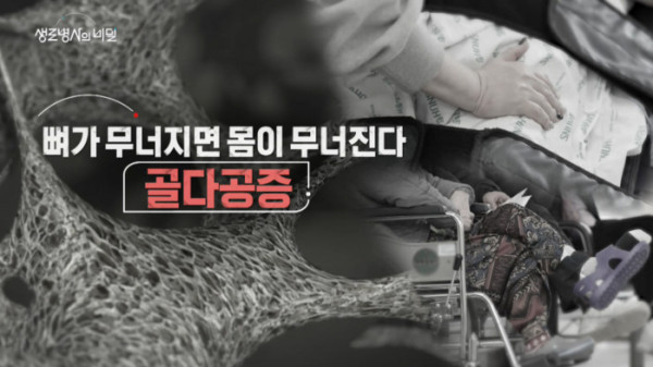 ▲'생로병사의_비밀'(사진제공=KBS 1TV)