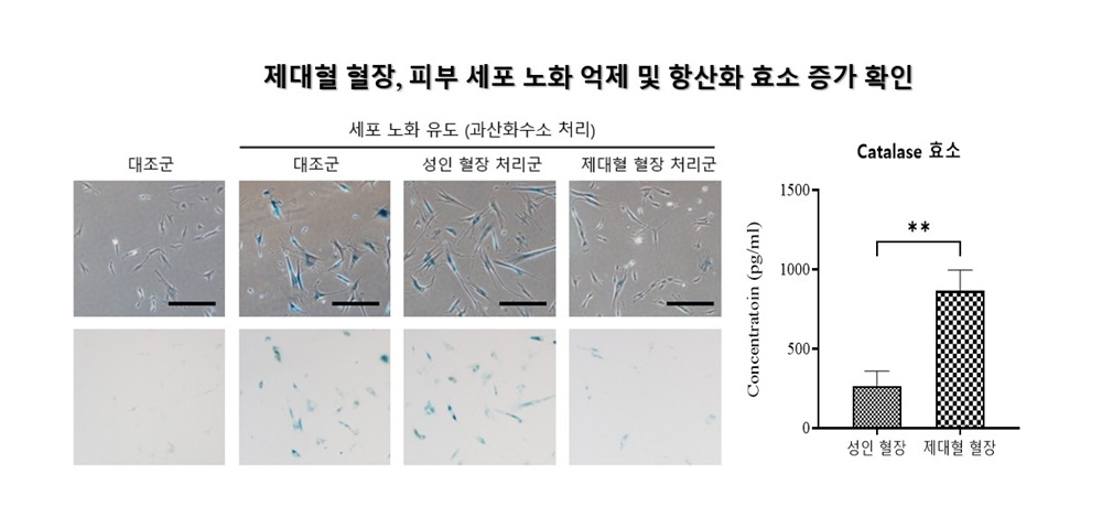 ▲메디포스트 첨단재생의료연구소 항노화연구팀은 '제대혈 혈장의 인간유래 피부섬유아세포에서 산화적 스트레스에 대한 세포 회복 촉진 및 노화 억제 효과’의 논문을 항노화 분야 권위 학술지 '리주베네이션 리서치(Rejuvenation Research)'에 게재했다. 연구에 따르면 세포 노화를 측정하는 대표적인 바이오마커인 에스에이-베타-갈(SA-β-gal) 염색 세포 수가 감소하고, 세포 노화와 손상에 관련된 유전자들(p16, p21, γH2AX)의 발현이 유의미하게 줄어든 것을 확인했다.  (자료제공=메디포스트)
