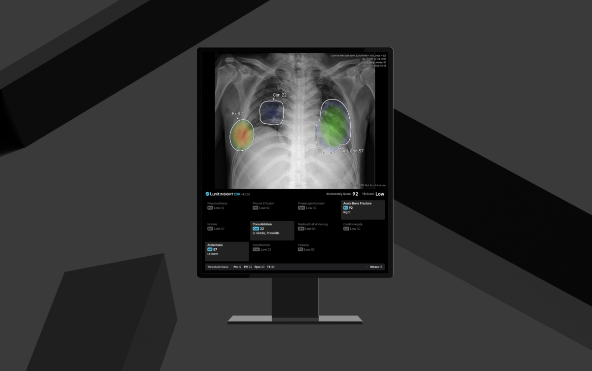 ▲루닛 AI 흉부 엑스레이 진단 솔루션 신제품 '루닛 인사이트 CXR4'. (사진제공=루닛)