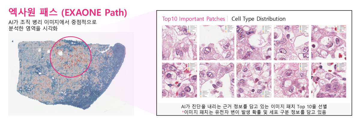 ▲엑사원 패스는 전체 슬라이드 이미지(WSI)에서 암과 관련된 유전자 변이를 예측할 수 있다. (자료제공=LG)