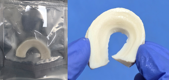 ▲엠젠솔루션 반월상 연골판 이식재.  (사진제공=엠젠솔루션)