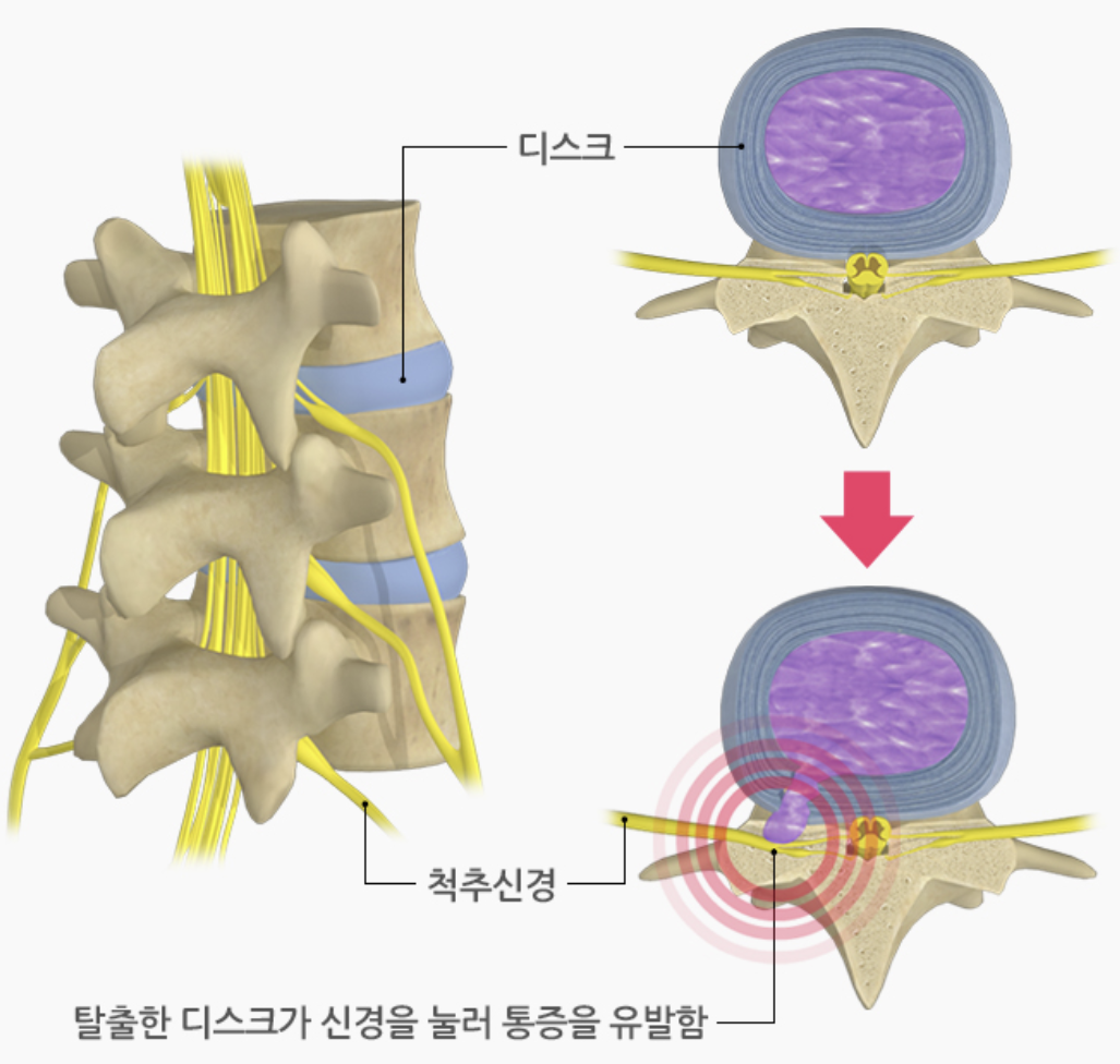 (질병관리청 국가건강정보포털)