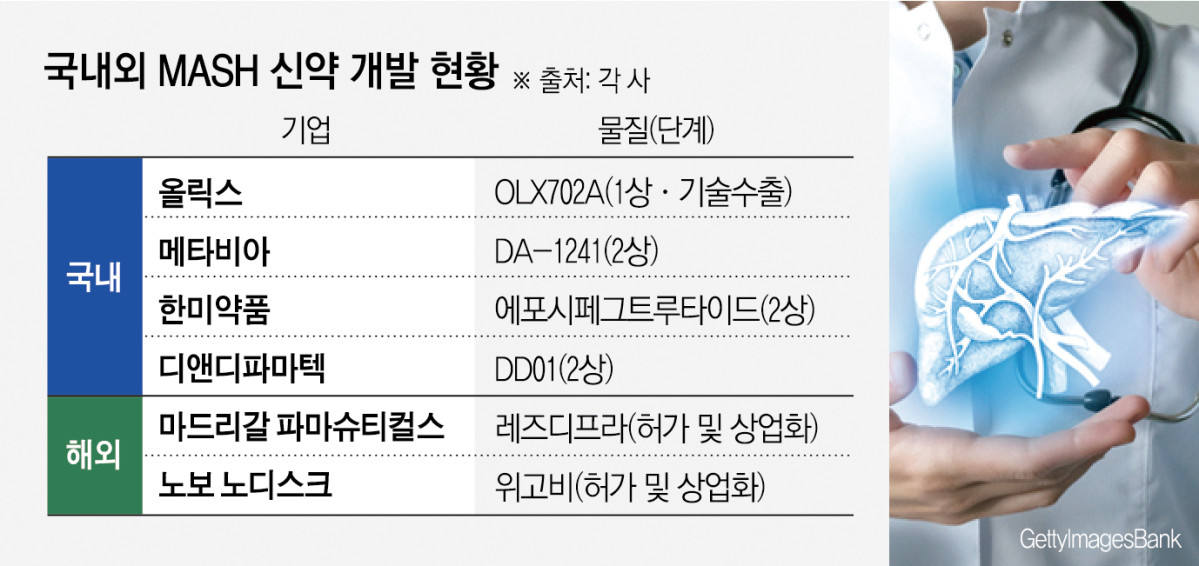 지방간염 환자 증가하는데…MASH 신약개발 잰걸음