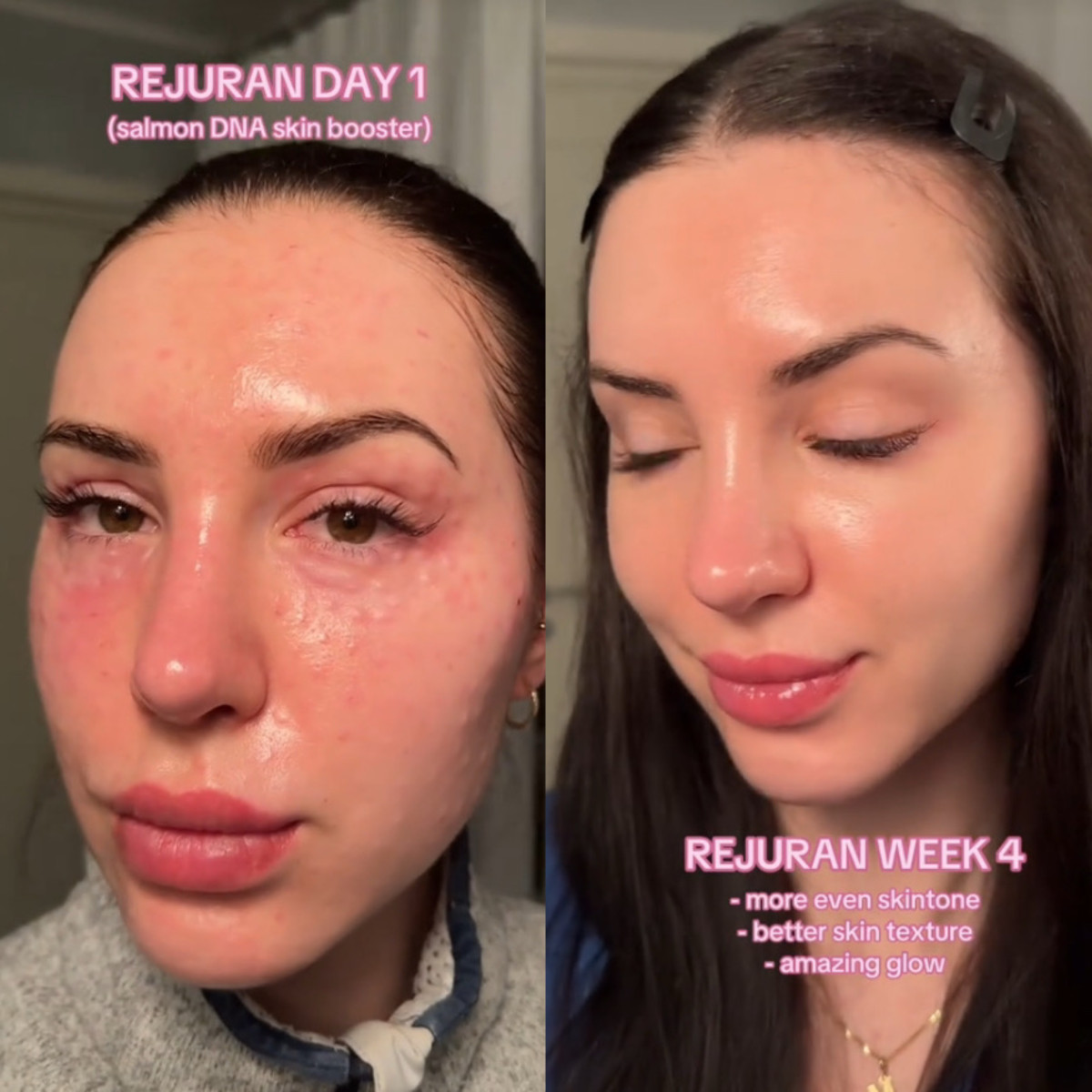 (출처=틱톡 '@dr.schirmer' 캡처)