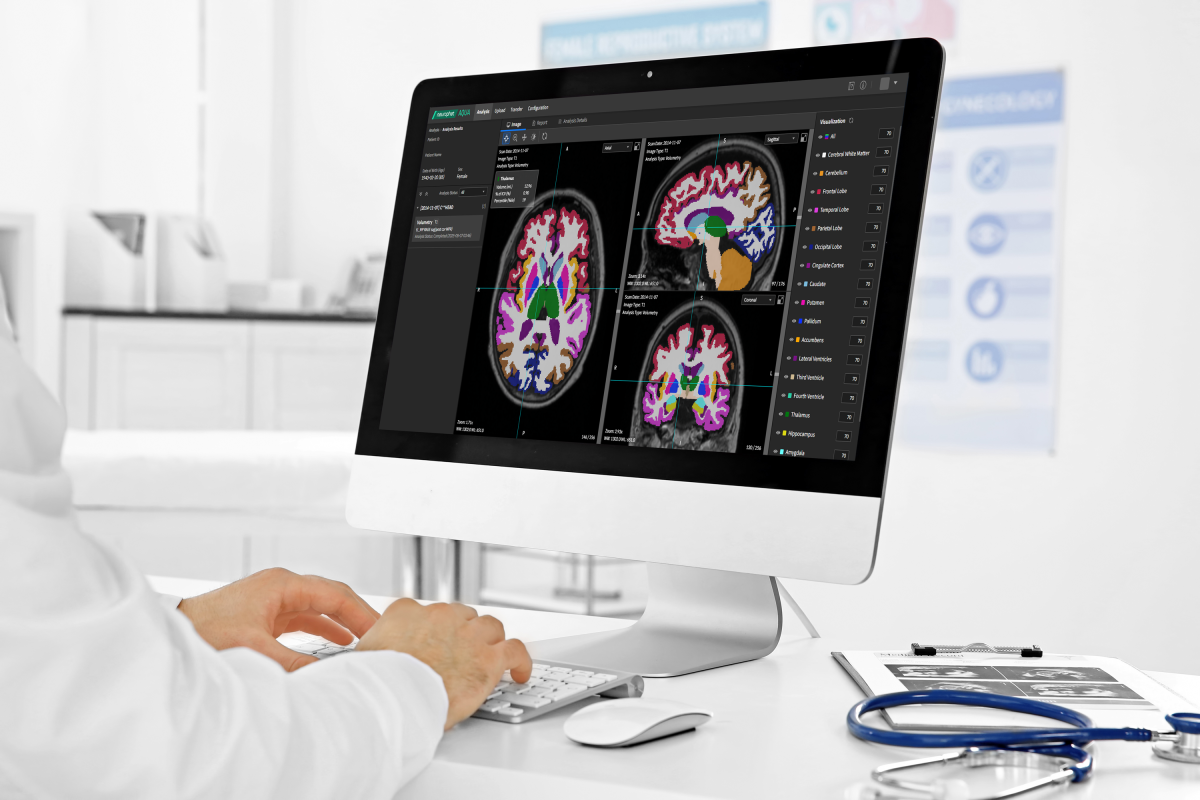▲뉴로핏의 뇌신경 퇴화 영상 분석 소프트웨어인 ‘뉴로핏 아쿠아’ (사진제공=뉴로핏)