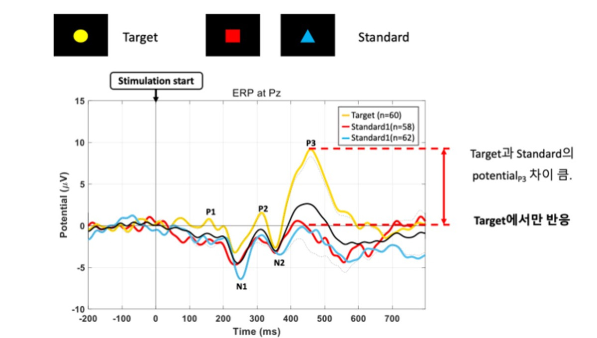 ▲ 와이브레인이 개발한 뇌파 진단 장비 마인드스캔의 P300 그래프. (사진제공=와이브레인)