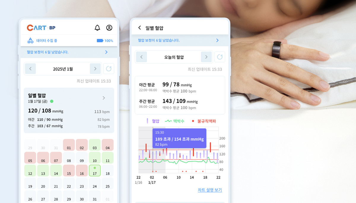 ▲반지형 혈압계 ‘카트 비피’ 와 혈압 관리 앱 ‘혈압 달력’(스카이랩스)