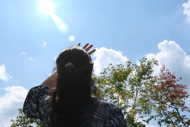 ▲유화정 고려대학교 안산병원 피부과 교수는 “가족력이 있거나 장시간 야외 활동을 하는 사람이라면 특히 주의가 필요하고, 피부에 관심을 가지고 조기에 치료하는 게 중요하다”고 당부했다. (사진제공=고려대 안산병원)