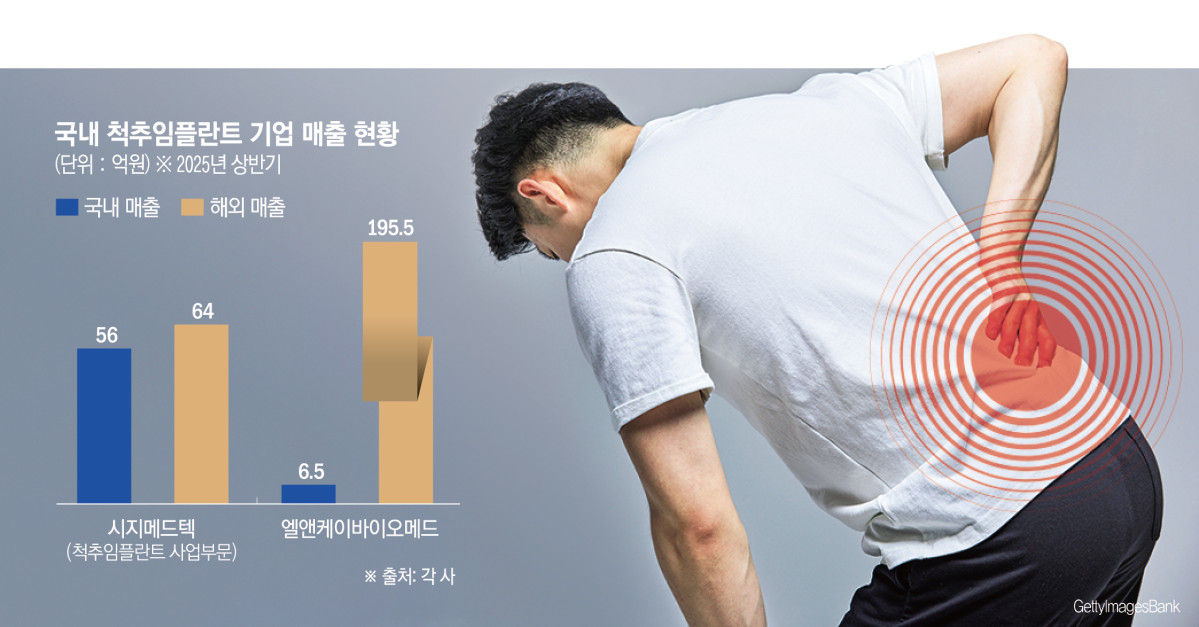 ‘한국은 좁다’…국산 척추임플란트, 미국·유럽서 훨훨