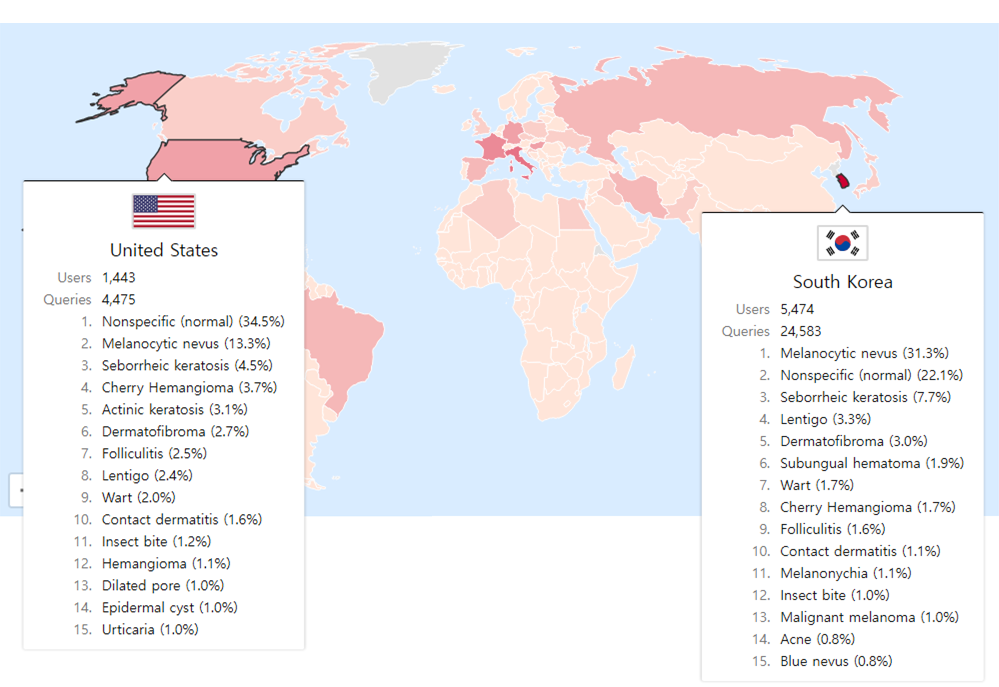 ▲[그림] stat.modelderm.com에서 공개하는 실시간 국가별 피부질환 발병 및 관심도 현황 (분당서울대병원)