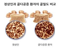 (서울아산병원)