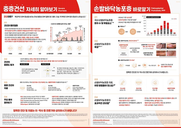 ▲중증 건선, 손·발바닥 농포증 인포그래픽 (존슨앤존슨 제공)