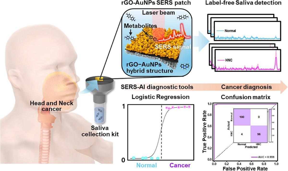 ▲비침습적 두경부암 진단 플랫폼 개요도 (서울성모병)