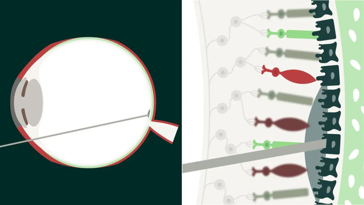伊아방가르드, 시리즈B 1.4억弗.."안구질환 유전자 PoC"
