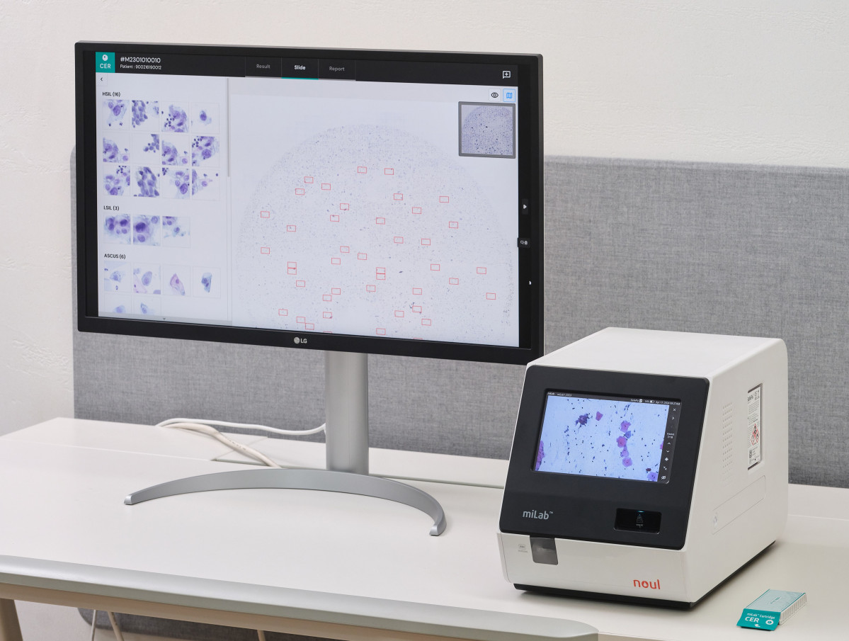 ▲ 노을 AI 기반 자궁경부암 진단 솔루션(miLab CER). (사진제공=노을)