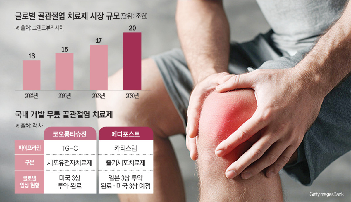 ‘근본적 치료제’ 없는 무릎 골관절염, K바이오가 제패할까