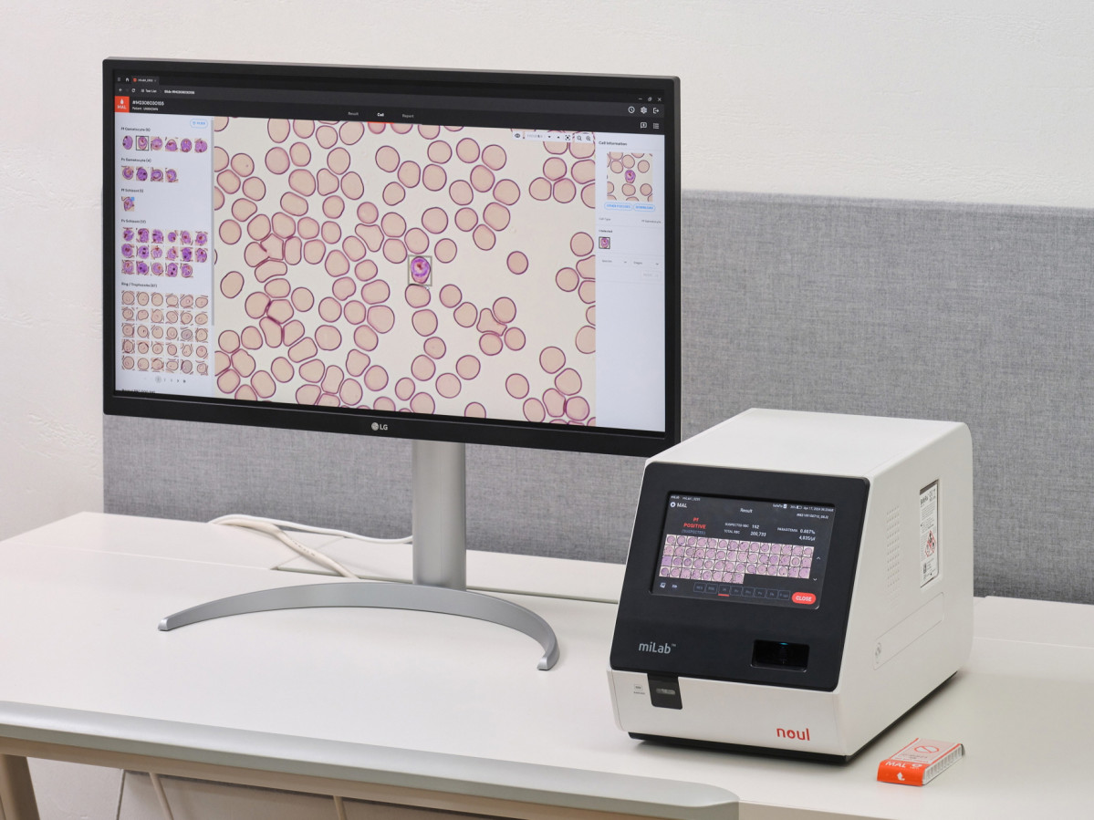 ▲노을의 인공지능(AI) 기반 말라리아 솔루션 ‘마이랩(miLab) MAL’ (노을)