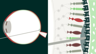 伊아방가르드, 시리즈B 1.4억弗.."안구질환 유전자 PoC"