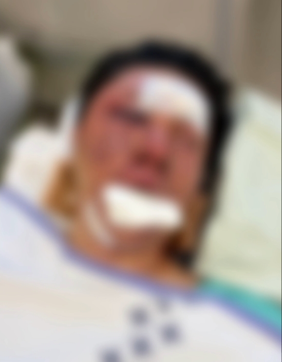 ▲수탉의 피해 당시 사진 (출처=SOOP ‘수탉’ 채널 캡처)