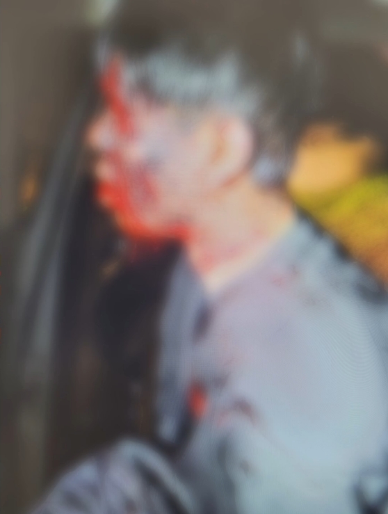 ▲수탉의 피해 당시 사진 (출처=SOOP ‘수탉’ 채널 캡처)