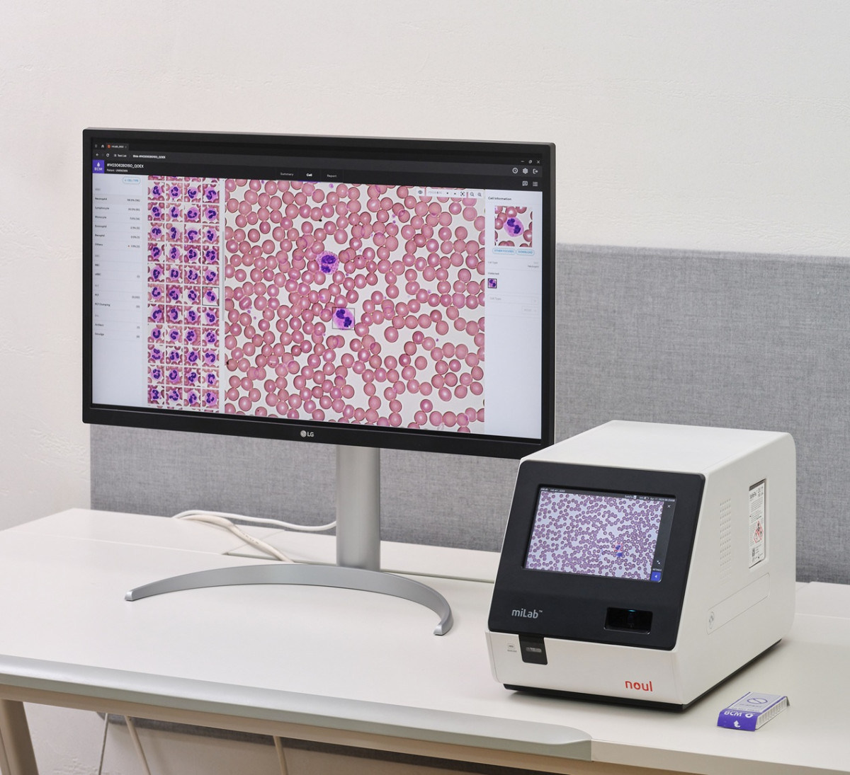 ▲전혈구검사(CBC)를 통합한 완전 자동화 혈액 분석 솔루션 ‘miLab BCM’. (사진제공=노을)