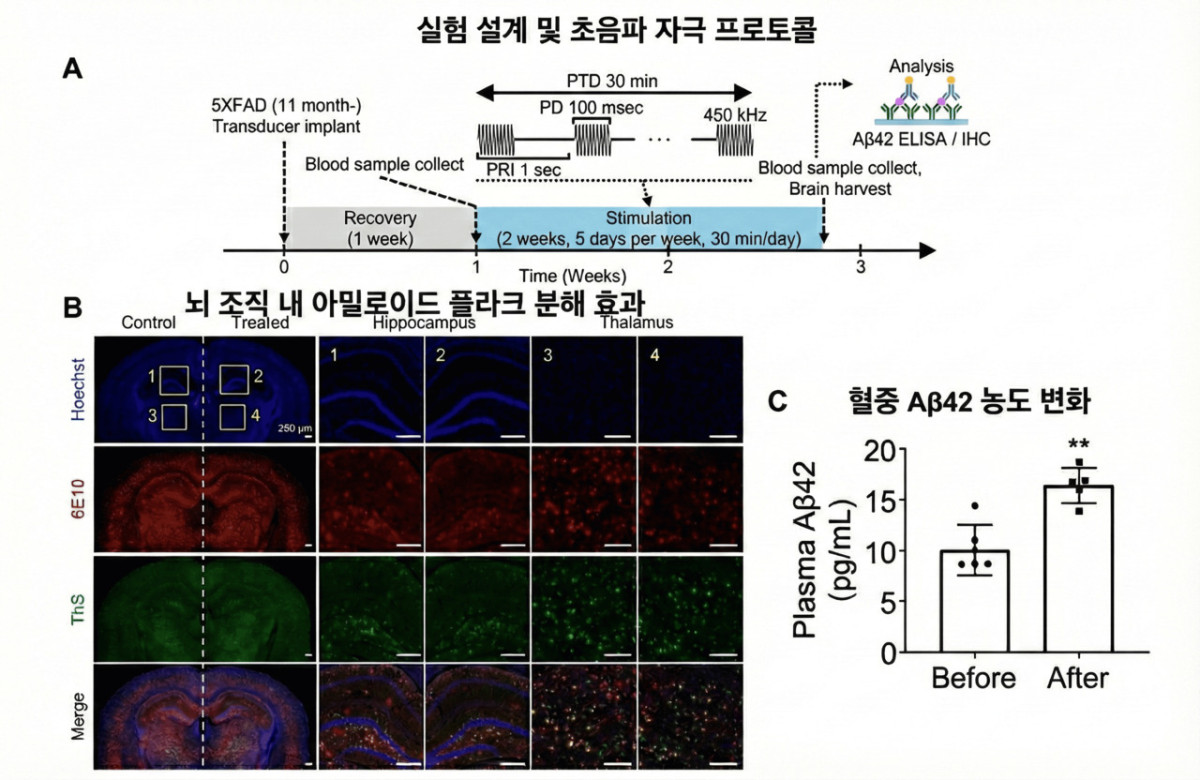 ▲쥐 실험에서 아밀로이드 플라크 제거 및 혈액 배출 확인 (사진제공=한림대동탄성심병원)