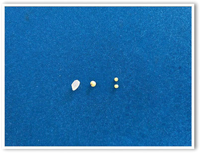 ▲쌀 한 톨이 보통 25㎎이고 좁쌀 한 톨이 2.5㎎인 걸 생각하면 혈압약 10㎎이 얼마나 미량인지 알 수 있다.