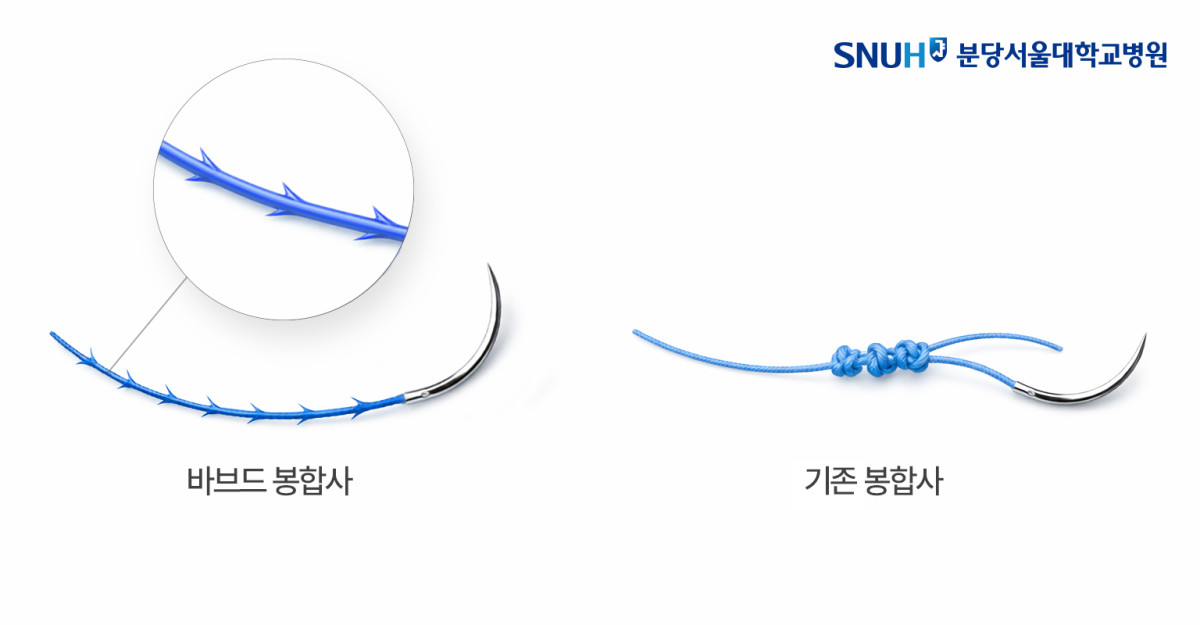 (분당서울대병원)