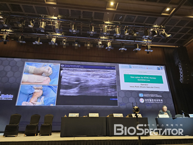 엔게인, ‘新하지정맥류 치료기기’ 출시..“3가지 경쟁력”