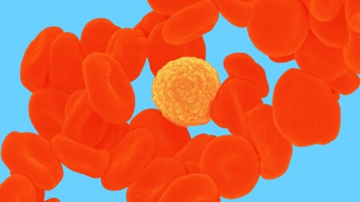 J&J "새 판도?", 초기서 'BCMAxCD3' "유례없는 효능"