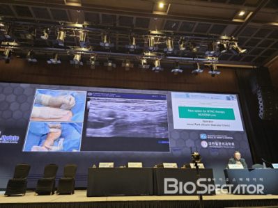 엔게인, ‘新하지정맥류 치료기기’ 출시..“3가지 경쟁력”