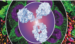 큐리언트, 獨 QLi5에 108억 유증..“차세대 PI-ADC"