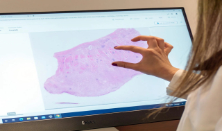 패스AI, MASH ‘병기진단 AI’ 임상시험 사용 “FDA 인증”