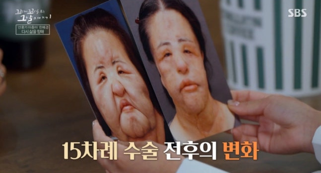 ▲SBS 꼬리에 꼬리는 무는 그날 이야기, '선풍기 아줌마' 한혜경 씨 조명, '꼬꼬무' 선풍기 아줌마, 2004년 세상에 이런일이 첫 방송 당시 모습 (출처=SBS '꼬리에 꼬리를 무는 그날 이야기' 캡처)