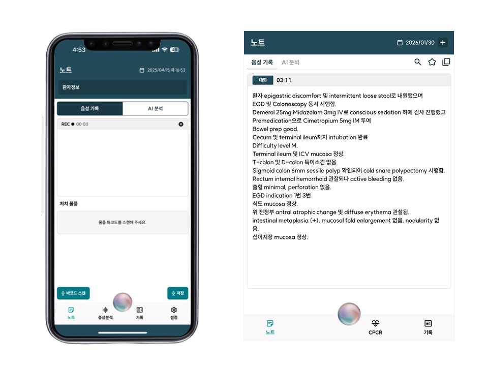 ▲인공지능(AI) 음성인식 기반 의무기록 자동화 솔루션 ‘젠노트(GenNote)’ 화면 (사진제공=대웅제약)
